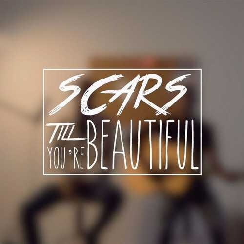 موزیک همرا با متن و ترجمه Alessia Cara-Scars To Your Beautiful